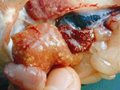 Cá tra bị mủ gan